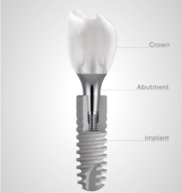 power of zirconia