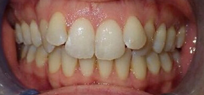 Before