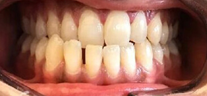 Before