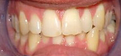 Before
